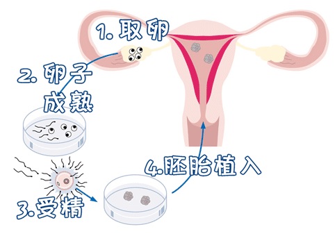 供卵代生套餐